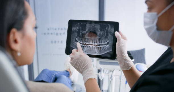 Licensed Tooth Extraction service in La Palma, CA - Smile Center Dentistry